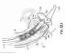Fig. 65 - Devices, systems and methods to improve placement and prevent heart block with percutaneous aortic valve replacement
