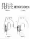 Fig. 04 - Non-occlusive dilation and deployment catheter device