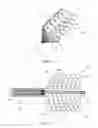 Fig. 08 - Non-occlusive dilation and deployment catheter device