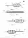 Fig. 09 - Non-occlusive dilation and deployment catheter device