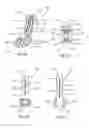 Fig. 07 - JOINT FUSION INSTRUMENTATION AND METHODS