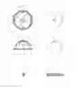 Fig. 03 - Prosthetic hip system