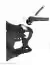 Fig. 16 - Prosthetic hip system