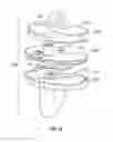Fig. 08 - Tibial insert