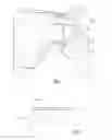 Fig. 02 - Glenohumeral component for a shoulder prosthesis, and shoulder prosthesis comprising such a glenohumeral component