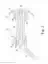 Fig. 03 - Adjustable height arthroplasty plate