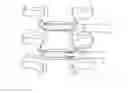 Fig. 01 - Intervertebral implant