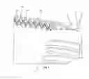 Fig. 06 - Intervertebral implant