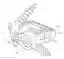 Fig. 01 - Spinal implant device with bone screws