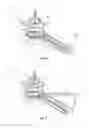 Fig. 06 - Spinal implant system and method