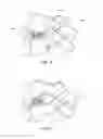 Fig. 07 - Spinal implant system and method
