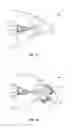 Fig. 09 - Spinal implant system and method