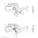 Fig. 06 - Method and apparatus for post-operative tuning of a spinal implant