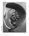Fig. 70 - METHOD OF FITTING A PROSTHETIC INTERFACE SYSTEM USING COMPLIANT MEMBERS