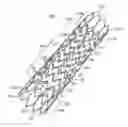 Fig. 01 - Stent