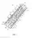 Fig. 02 - Stent
