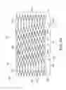 Fig. 09 - Stent