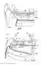 Fig. 06 - Shoulder and arm orthosis