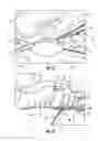 Fig. 08 - Shoulder and arm orthosis