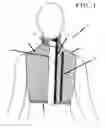 Fig. 02 - Gird compression tensioning garment with cervical collar