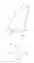 Fig. 02 - A NASAL SPLINT