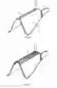 Fig. 05 - A NASAL SPLINT