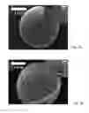 Fig. 02 - IMPLANT AND IMPLANTATION TOOL ADAPTED FOR OCCLUDING FALLOPIAN TUBES OF PLACENTAL MAMMALS