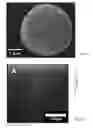 Fig. 03 - IMPLANT AND IMPLANTATION TOOL ADAPTED FOR OCCLUDING FALLOPIAN TUBES OF PLACENTAL MAMMALS