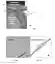 Fig. 05 - IMPLANT AND IMPLANTATION TOOL ADAPTED FOR OCCLUDING FALLOPIAN TUBES OF PLACENTAL MAMMALS