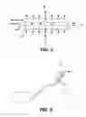 Fig. 04 - METHOD AND DEVICE FOR NON-INVASIVE ANATOMICAL AND SYSTEMIC COOLING AND NEUROPROTECTION