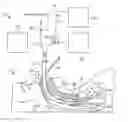 Fig. 01 - Systems and methods for endotracheal delivery of frozen particles