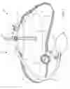 Fig. 02 - Non-surgical torso deformity correction devices and methods related thereto