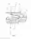Fig. 04 - SAFE TABLET CUTTING DEVICE
