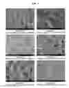 Fig. 10 - Oral composition