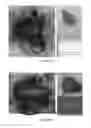 Fig. 48 - SELECTIVE INHIBITORS OF UNDIFFERENTIATED CELLS