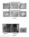 Fig. 50 - SELECTIVE INHIBITORS OF UNDIFFERENTIATED CELLS
