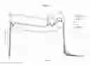 Fig. 09 - TREPROSTINIL PRODRUGS