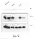 Fig. 06 - Methods for identifying and using inhibitors of casein kinase 1 epsilon isoform for inhibiting the growth and/or proliferation of MYC-driven tumor cells