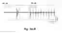 Fig. 06 - Mitigation of epileptic seizures by combination therapy using benzodiazepines and neurosteroids