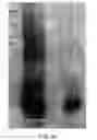 Fig. 22 - Inactivated Bacterial Cell Formulation