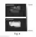 Fig. 05 - COMPOSITIONS AND METHODS RELATED TO CELL SYSTEMS FOR PENETRATING SOLID TUMORS