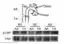 Fig. 01 - COMPOSITIONS AND METHODS FOR TREATMENT AND PREVENTION OF CARDIOVASCULAR DISEASES