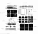 Fig. 02 - COMPOSITIONS AND METHODS FOR TREATMENT AND PREVENTION OF CARDIOVASCULAR DISEASES