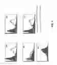 Fig. 03 - ABERRANT CELL-RESTRICTED IMMUNOGLOBULINS PROVIDED WITH A TOXIC MOIETY