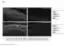 Fig. 09 - PROMOTERS, EXPRESSION CASSETTES, VECTORS, KITS, AND METHODS FOR THE TREATMENT OF ACHROMATOPSIA AND OTHER DISEASES