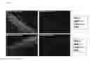 Fig. 10 - PROMOTERS, EXPRESSION CASSETTES, VECTORS, KITS, AND METHODS FOR THE TREATMENT OF ACHROMATOPSIA AND OTHER DISEASES