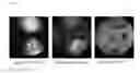 Fig. 11 - PROMOTERS, EXPRESSION CASSETTES, VECTORS, KITS, AND METHODS FOR THE TREATMENT OF ACHROMATOPSIA AND OTHER DISEASES