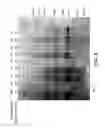 Fig. 10 - System and Method For Sterilizing and/or Deimmunizing an Object