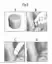 Fig. 09 - Optimized solid substrates, tools for use with same and uses thereof for promoting cell and tissue growth