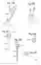 Fig. 14 - Optimized solid substrates, tools for use with same and uses thereof for promoting cell and tissue growth